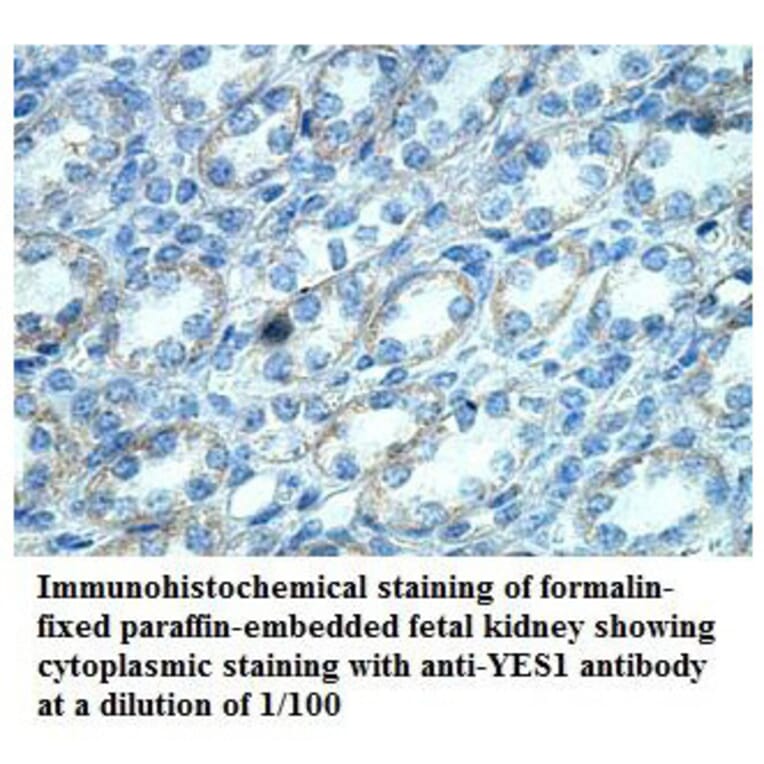 YES1 Antibody from Signalway Antibody (39868) - Antibodies.com