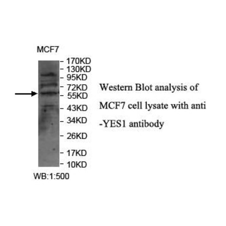YES1 Antibody from Signalway Antibody (39868) - Antibodies.com
