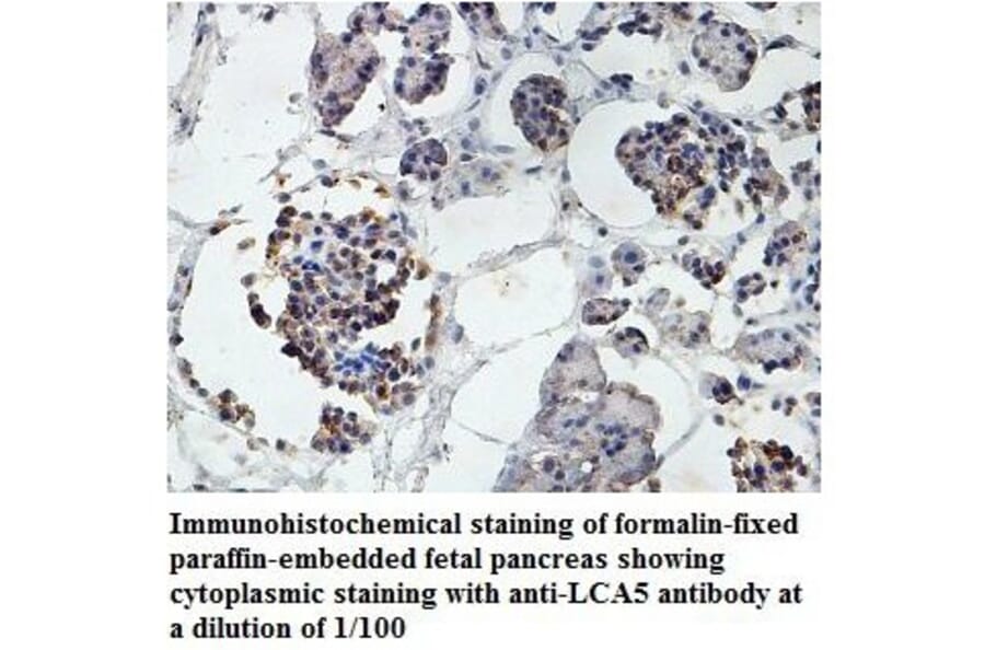 LCA5 Antibody from Signalway Antibody (39878) - Antibodies.com