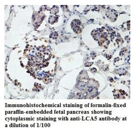 LCA5 Antibody from Signalway Antibody (39878) - Antibodies.com