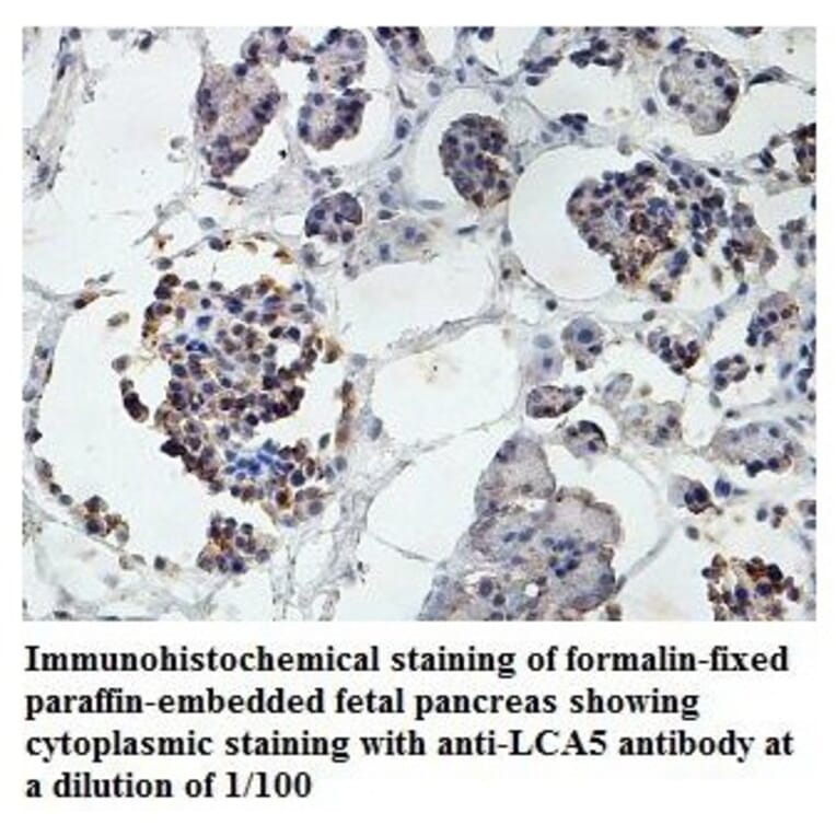 LCA5 Antibody from Signalway Antibody (39878) - Antibodies.com