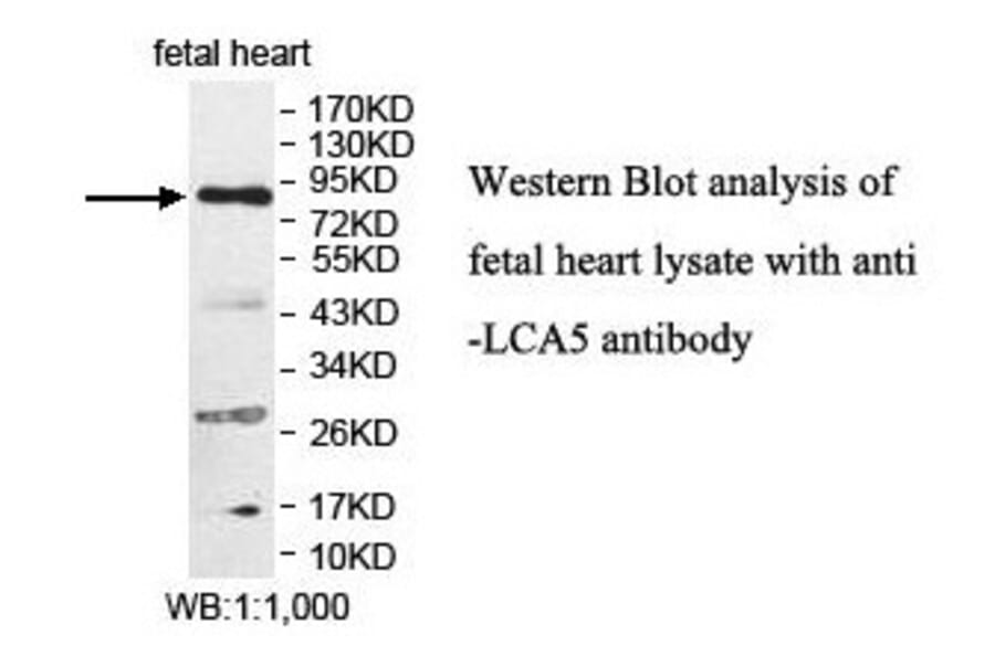 LCA5 Antibody from Signalway Antibody (39878) - Antibodies.com