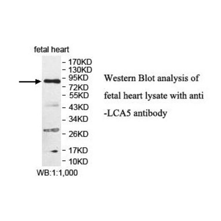LCA5 Antibody from Signalway Antibody (39878) - Antibodies.com
