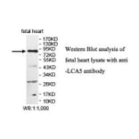 LCA5 Antibody from Signalway Antibody (39878) - Antibodies.com