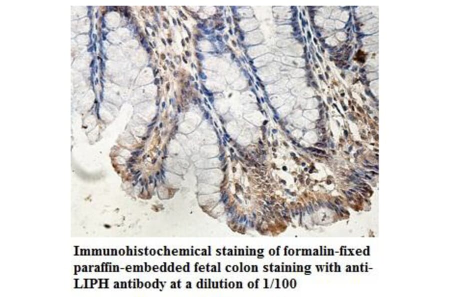 LIPH Antibody from Signalway Antibody (39893) - Antibodies.com