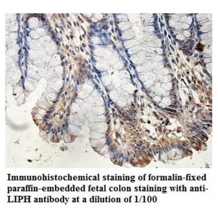 LIPH Antibody from Signalway Antibody (39893) - Antibodies.com