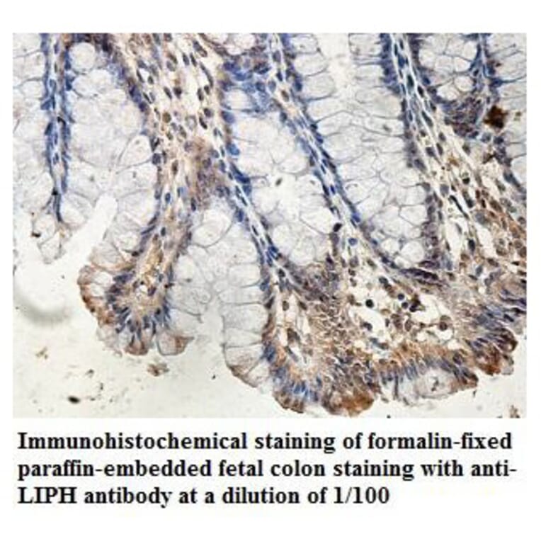 LIPH Antibody from Signalway Antibody (39893) - Antibodies.com