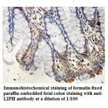 LIPH Antibody from Signalway Antibody (39893) - Antibodies.com