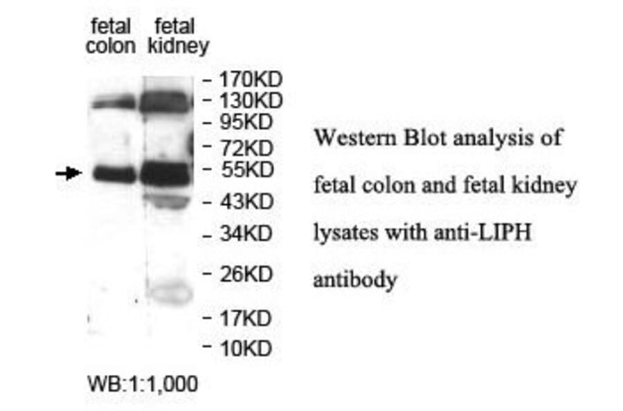 LIPH Antibody from Signalway Antibody (39893) - Antibodies.com