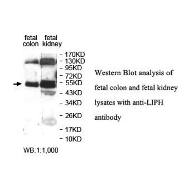 LIPH Antibody from Signalway Antibody (39893) - Antibodies.com