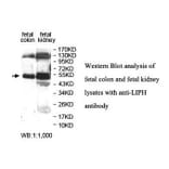 LIPH Antibody from Signalway Antibody (39893) - Antibodies.com