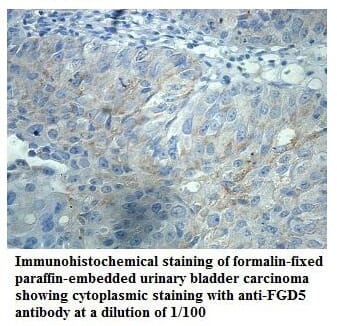 Anti-FGD5 Antibody