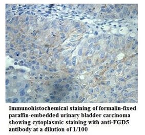 FGD5 Antibody from Signalway Antibody (39907) - Antibodies.com