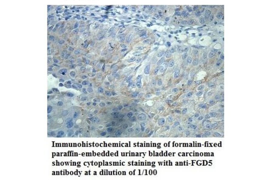 FGD5 Antibody from Signalway Antibody (39907) - Antibodies.com