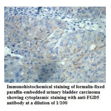 FGD5 Antibody from Signalway Antibody (39907) - Antibodies.com