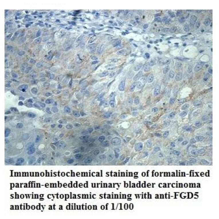 FGD5 Antibody from Signalway Antibody (39907) - Antibodies.com