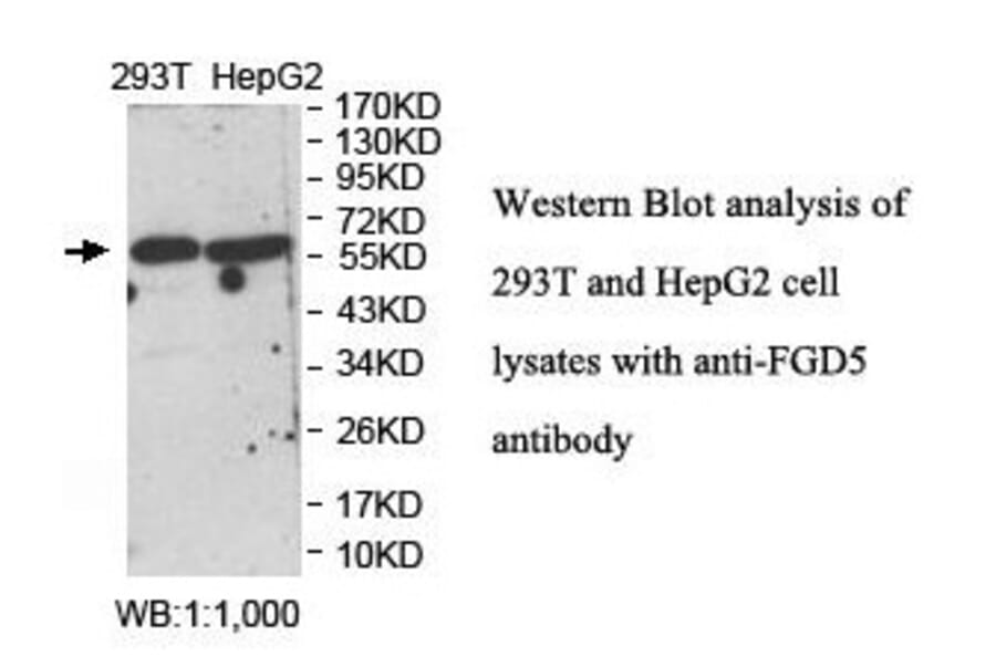 FGD5 Antibody from Signalway Antibody (39907) - Antibodies.com