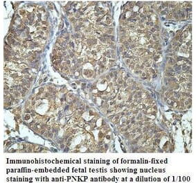 PNKP Antibody from Signalway Antibody (39908) - Antibodies.com