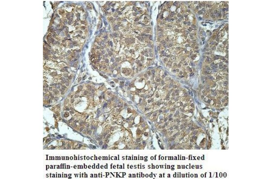 PNKP Antibody from Signalway Antibody (39908) - Antibodies.com