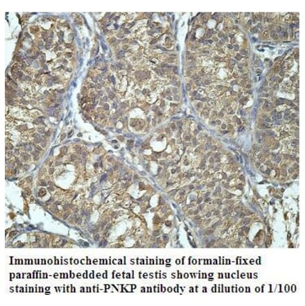 PNKP Antibody from Signalway Antibody (39908) - Antibodies.com