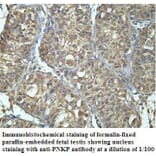 PNKP Antibody from Signalway Antibody (39908) - Antibodies.com