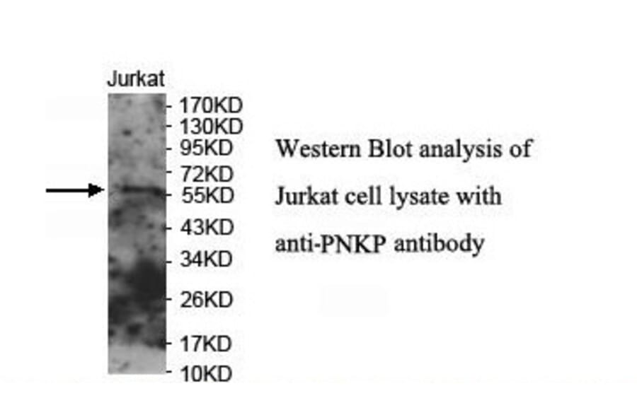PNKP Antibody from Signalway Antibody (39908) - Antibodies.com