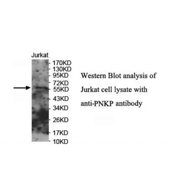 PNKP Antibody from Signalway Antibody (39908) - Antibodies.com