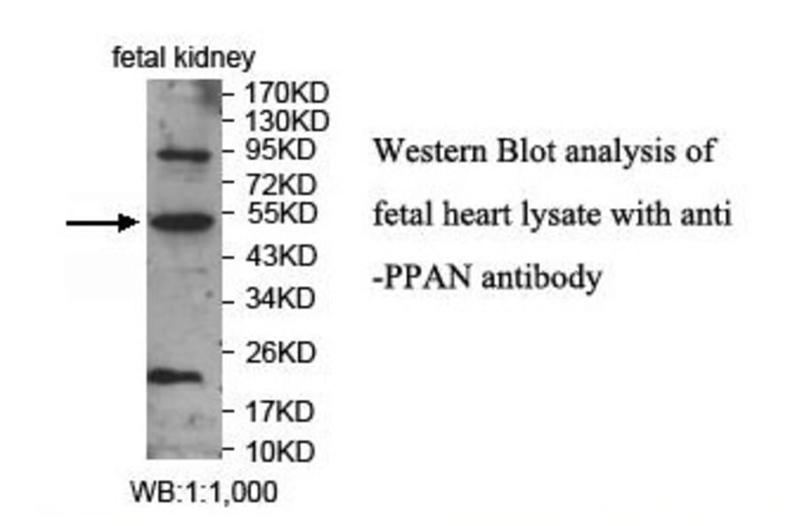 PPAN Antibody from Signalway Antibody (39913) - Antibodies.com