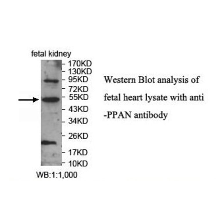 PPAN Antibody from Signalway Antibody (39913) - Antibodies.com