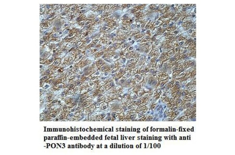 PON3 Antibody from Signalway Antibody (39919) - Antibodies.com