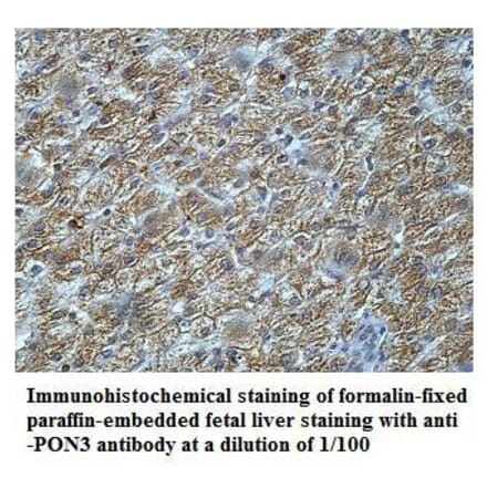 PON3 Antibody from Signalway Antibody (39919) - Antibodies.com