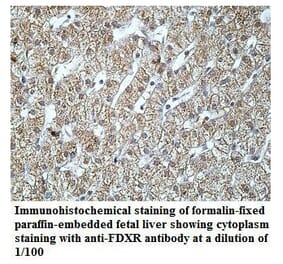 FDXR Antibody from Signalway Antibody (39920) - Antibodies.com