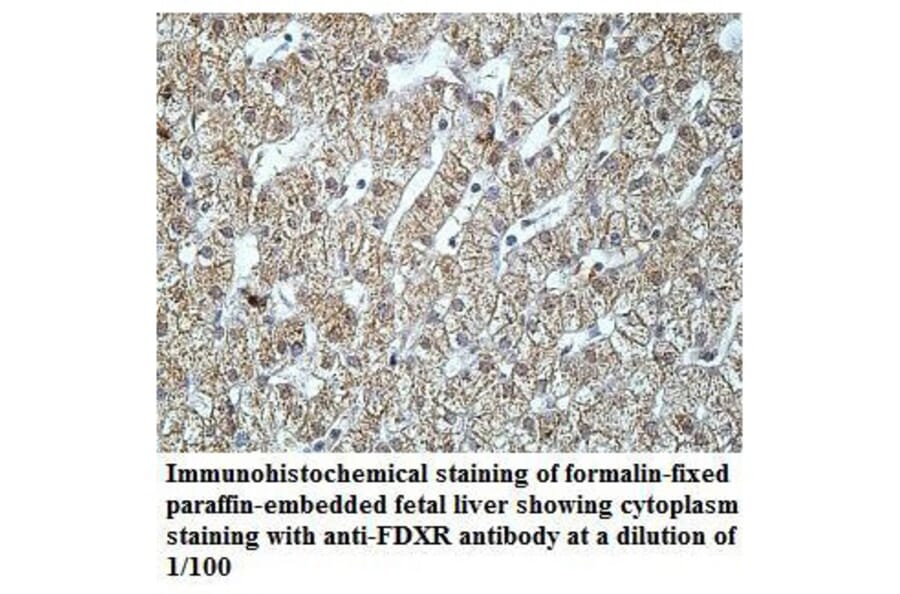 FDXR Antibody from Signalway Antibody (39920) - Antibodies.com