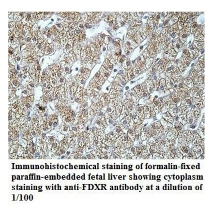 FDXR Antibody from Signalway Antibody (39920) - Antibodies.com