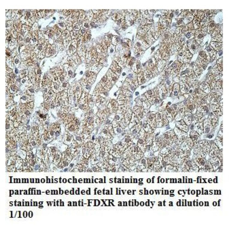 FDXR Antibody from Signalway Antibody (39920) - Antibodies.com