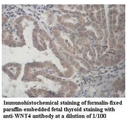 WNT4 Antibody from Signalway Antibody (39960) - Antibodies.com