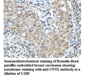 VNN2 Antibody from Signalway Antibody (39964) - Antibodies.com