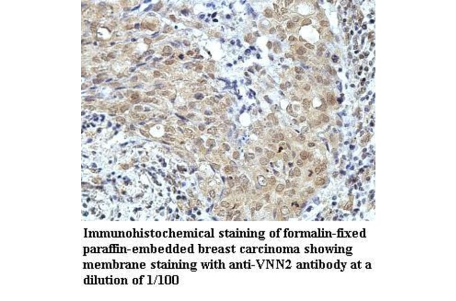VNN2 Antibody from Signalway Antibody (39964) - Antibodies.com