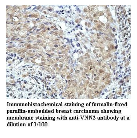VNN2 Antibody from Signalway Antibody (39964) - Antibodies.com