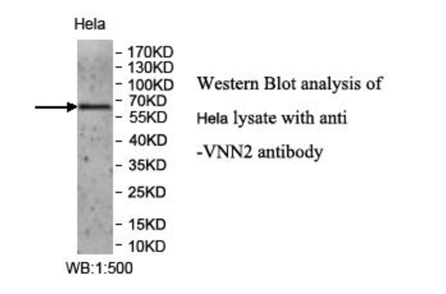 VNN2 Antibody from Signalway Antibody (39964) - Antibodies.com