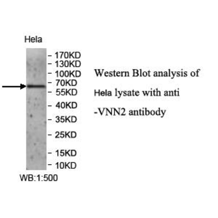 VNN2 Antibody from Signalway Antibody (39964) - Antibodies.com