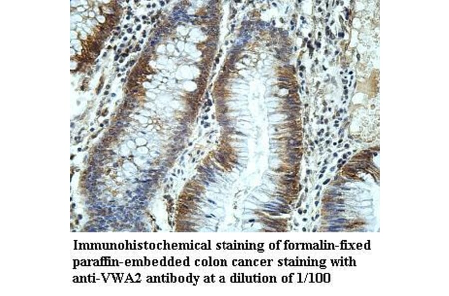 VWA2 Antibody from Signalway Antibody (39967) - Antibodies.com