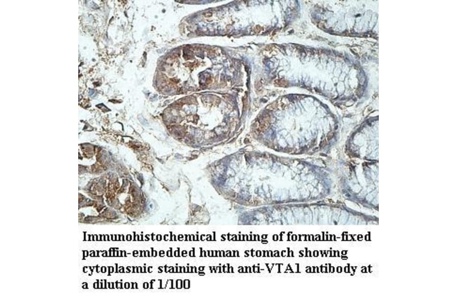 VTA1 Antibody from Signalway Antibody (39969) - Antibodies.com