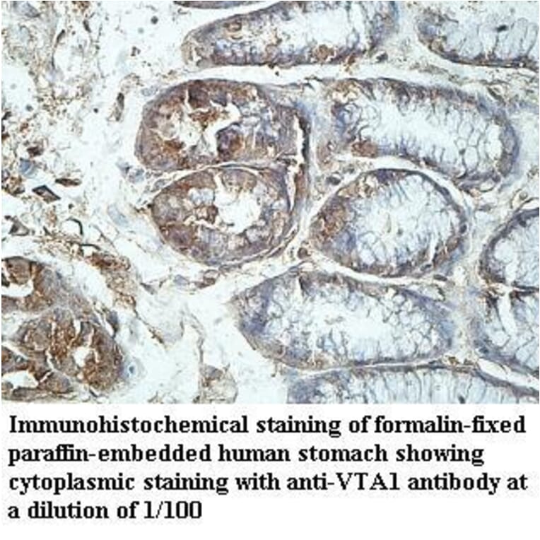 VTA1 Antibody from Signalway Antibody (39969) - Antibodies.com
