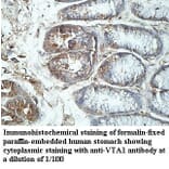 VTA1 Antibody from Signalway Antibody (39969) - Antibodies.com