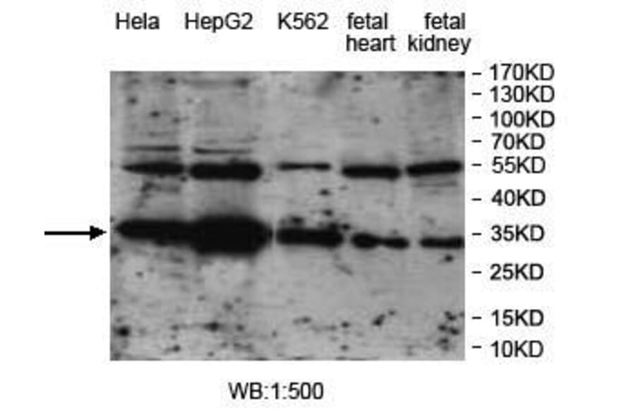 VTA1 Antibody from Signalway Antibody (39969) - Antibodies.com