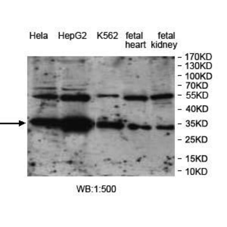 VTA1 Antibody from Signalway Antibody (39969) - Antibodies.com