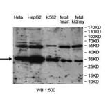 VTA1 Antibody from Signalway Antibody (39969) - Antibodies.com