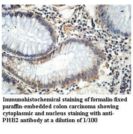 PHB2 Antibody from Signalway Antibody (39972) - Antibodies.com