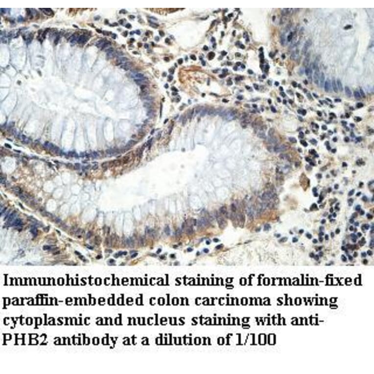 PHB2 Antibody from Signalway Antibody (39972) - Antibodies.com
